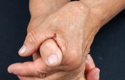 Osteoarthritis Management