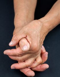 Osteoarthritis Management: How To Manage OA In Hands And Feet