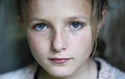 Osteoarthritis in Children