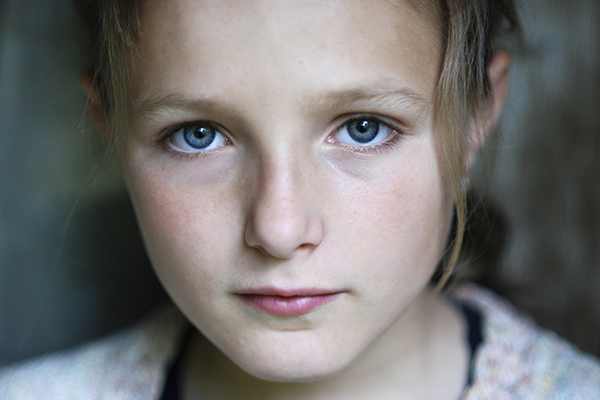 Osteoarthritis In Children Causes Of Early Onset OA And Its Symptoms osteoarthritis-in-children-causes-of-early-onset-oa-and-its-symptoms