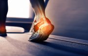 Osteoarthritis vs Rheumatoid Arthritis