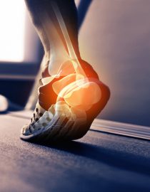 Osteoarthritis and Rheumatoid Arthritis: What’s the Difference? Osteoarthritis and Rheumatoid Arthritis: What’s the Difference?