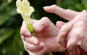 Arthritis Trigger Finger