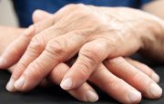 Inflammatory Arthritis
