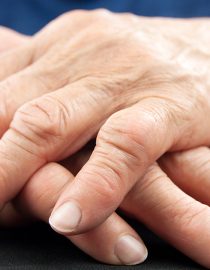 What Is Inflammatory Osteoarthritis? What Is Inflammatory Osteoarthritis?
