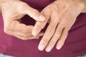 Osteoarthritis in Fingers